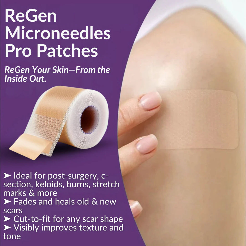 Official Store: ReGen Microneedles Pro Patches with Hyaluronic Acid Nano-Heal Treatment for new and old scars, reduction of surgical scars, stretch marks, keloids, acne, burns, warts, dermatomas, and varicose veins