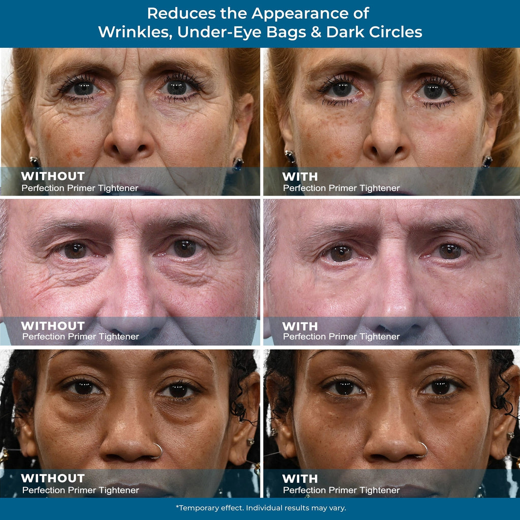 Instant Eye Firming Serum - Instantly Visibly Reduces Under-Eye Bags, Wrinkles, Dark Circles, Fine Lines, and Crow's Feet. Anti-Aging and Anti-Wrinkle Treatment for Full Face Size Tube.