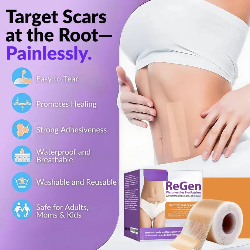 Official Store: ReGen Microneedles Pro Patches with Hyaluronic Acid Nano-Heal Treatment for new and old scars, reduction of surgical scars, stretch marks, keloids, acne, burns, warts, dermatomas, and varicose veins